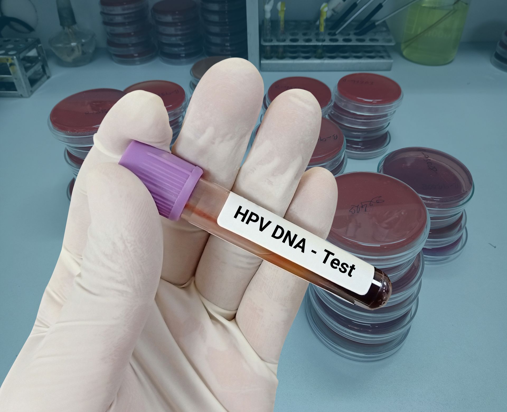 ตรวจ มะเร็งปากมดลูก HPV DNA test ฟรี 