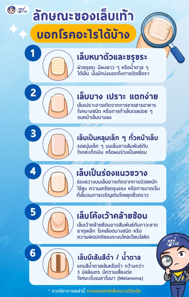 เล็บเท้าบอกโรคมะเร็งได้ไหม