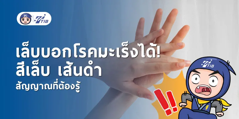 สังเกตเล็บบอกโรคมะเร็ง สัญญาณเตือนที่ไม่ควรมองข้าม