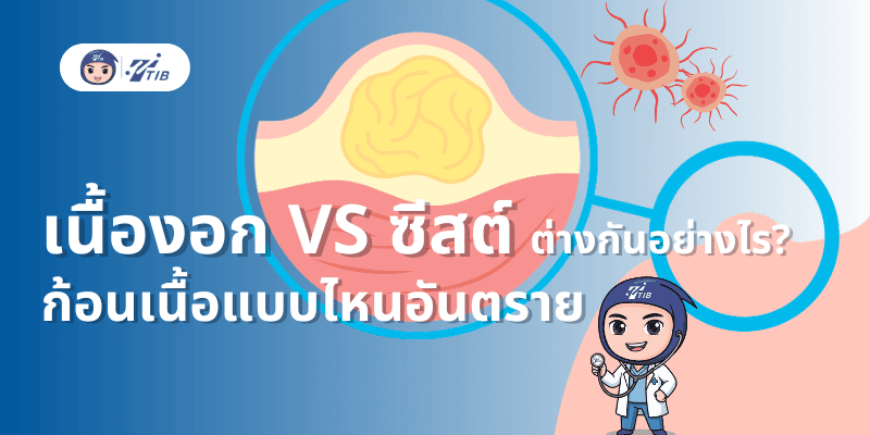 เนื้องอกกับซีสต์ต่างกันยังไง ก้อนเนื้อแบบไหนอันตราย